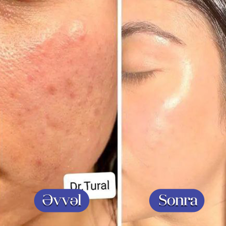 Kosmetoloq Dr. Şural Həbibov bir çox kosmetoloji prosedurları yüksək səviyyədə icra edir