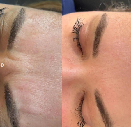 Kosmetoloq Dr. Şural Həbibov bir çox kosmetoloji prosedurları yüksək səviyyədə icra edir